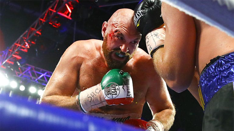 Your say: The story of Tyson Fury is up there with that of Joe Louis and Muhammad Ali